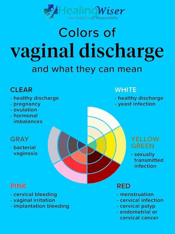 7 Vaginal Discharge Colors: Types of Discharge